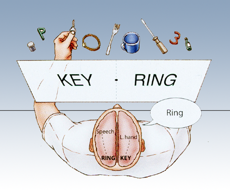 Split Brain